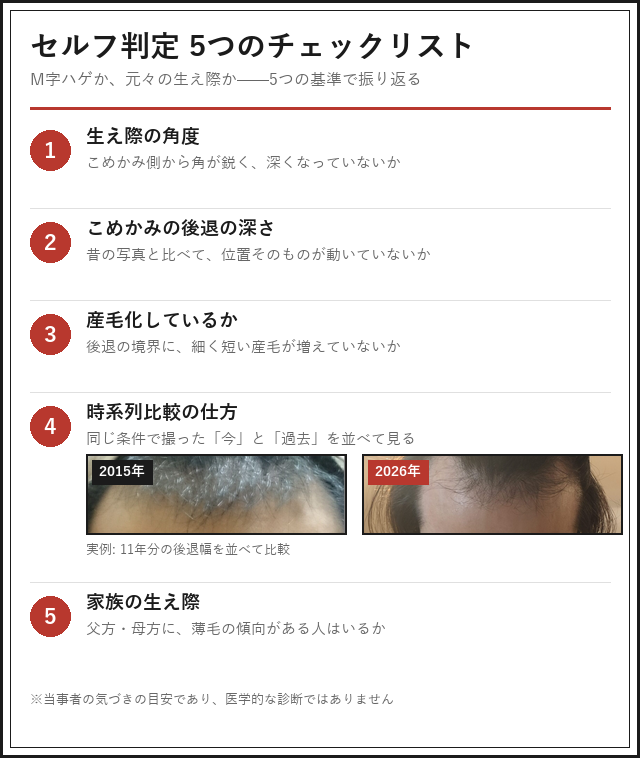 M字ハゲかどうかを見分ける5つの判断基準のチェックリスト図解