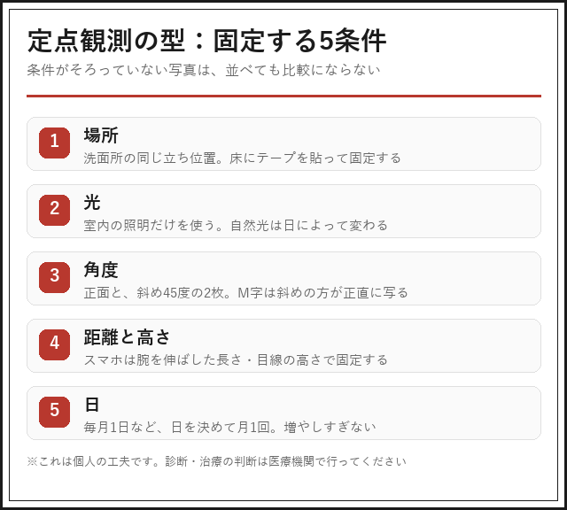 定点観測で固定する5条件（場所・光・角度・距離と高さ・日）をまとめた図解