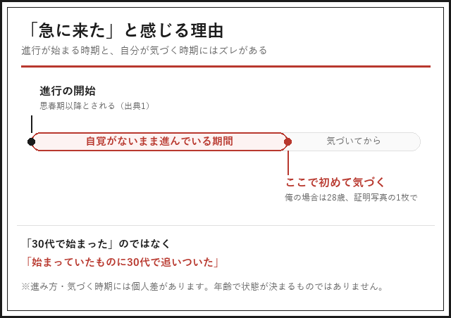 AGAの進行が始まる時期と、本人が自覚する時期のズレを示した図解
